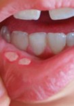بیماری های دهان