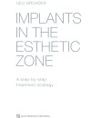 356-RP-Implants in the Esthetic Zone (2016)-cover.jpg