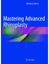 392-RP-Mastering Advanced Rhinoplasty (2017).jpg