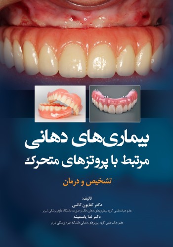 بیماریهای دهانی مرتبط با پروتزهای متحرک تشخیص و درمان