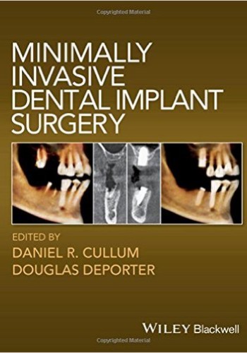 Minimally Invasive Dental Implant Surgery 2015