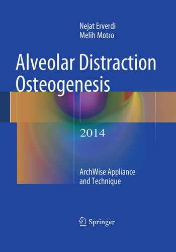 Alveolar Distraction Osteogenesis 2014