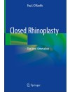 Closed Rhinoplasty.JPG
