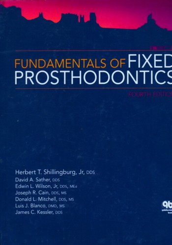 Fundamentals of Fixed Prosthodontics (Shillingburg) 2012