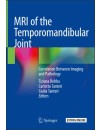MRI of the Temporomandibular Joint.JPG