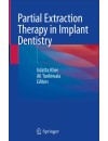 Partial Extraction Therapy in Implant Dentistry.JPG