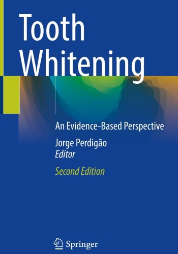 Tooth Whitening: An Evidence-Based Perspective 2023