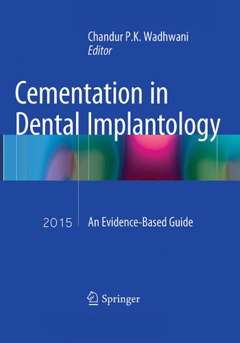 Cementation in Dental Implantology 2015