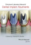Clinical and Laboratory Manual of Dental Implant Abutments 2014