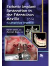 final . jeld - 09-RP-Esthetic Implant Restoration in the Edentulous Maxilla.jpg