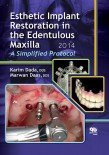 Esthetic Implant Restoration in the Edentulous Maxilla 2014