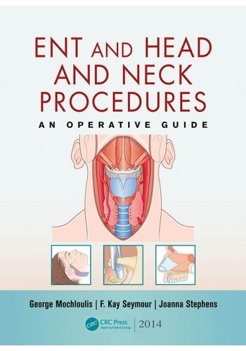ENT AND HEAD AND NECK PROCEDURES