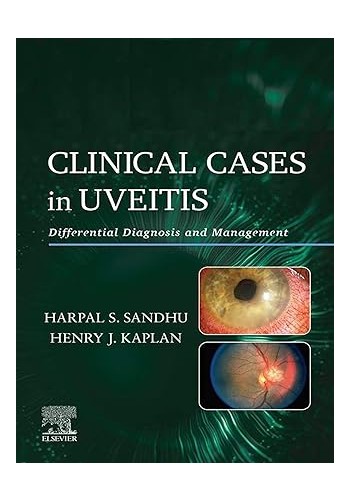 Clinical Cases in Uveitis: Differential Diagnosis and Management