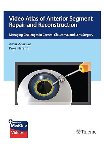 Video Atlas of Anterior Segment Repair and Reconstruction: Managing Challenges in Cornea , Glaucoma , and Lens Surgery 