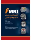 fMRI.jpg